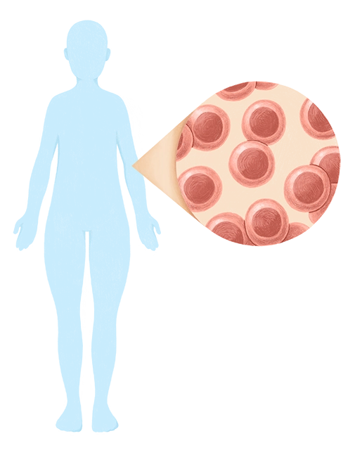 Illustration of an anonymous healthy donor in silhouette, with an inset showing stem cells.